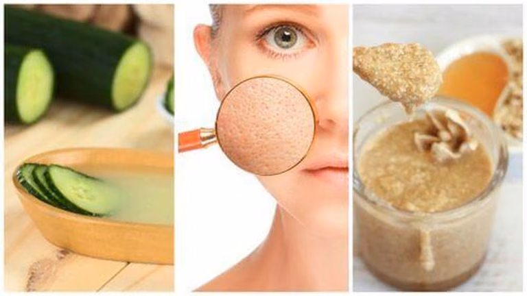 5 naturalnych produktów, które oczyszczają i zwężają pory