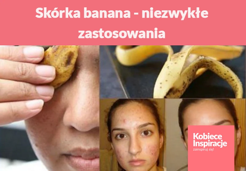 Skórka banana - niezwykłe zastosowania