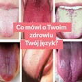 Co mówi o Twoim zdrowiu Twój język?