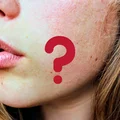 Włoski na brodzie u kobiety? O czym świadczą?