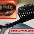 HIT! Czarna pasta która WYBIELI ZĘBY!