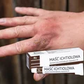 Maść ichtiolowa - HIT z apteki za 5 zł! Bez recepty!