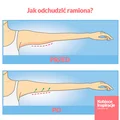 Jak odchudzić ramiona? - zobacz WIDEO z ćwiczeniami