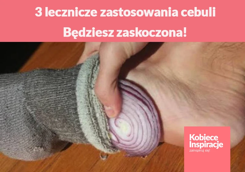 3 lecznicze zastosowania cebuli. Będziesz zaskoczona!