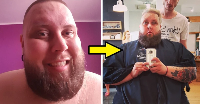 Gwiazda “Googlebox” pozuje nago po zrzuceniu 160 kilogramów!