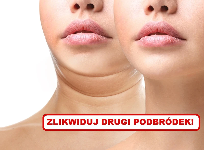Jak zlikwidować DRUGI PODBRÓDEK?