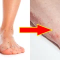 SWĘDZĄ CIĘ STOPY? Sprawdź co może być powodem