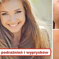 Jeżeli chcesz się cieszyć piękną skórą BEZ PODRAŻNIEŃ I WYPRYSKÓW – pamiętaj o tym!