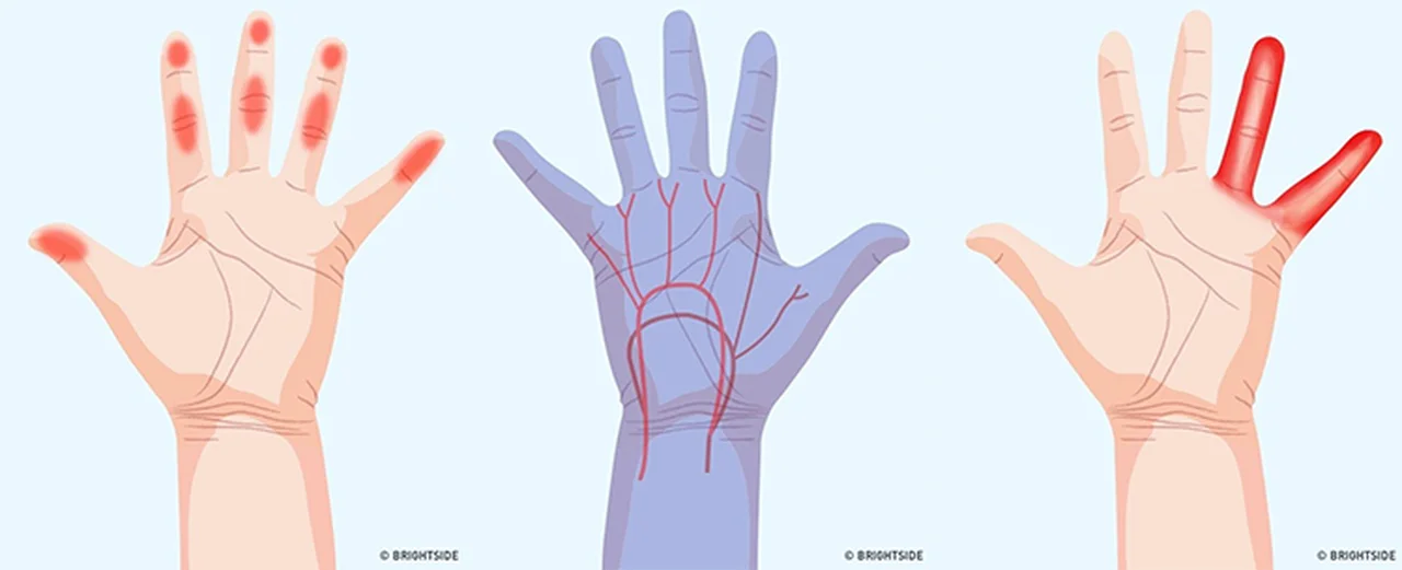 Czy można odczytać z dłoni stan swojego zdrowia? Masz któryś z tych objawów?