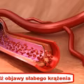 Te oznaki mogą świadczyć o ZŁYM KRĄŻENIU