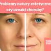 Problemy natury estetycznej, czy oznaki choroby?