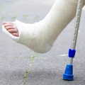 Tych kosztów nie obejmuje EKUZ! Wakacyjne problemy zdrowotne mogą kosztować fortunę
