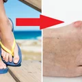 Chodzenie w japonkach jest szkodliwe. Poznaj 4 wady tego obuwia