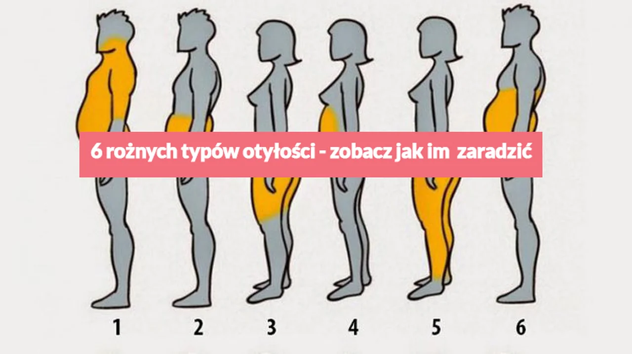 6 rożnych typów otyłości - zobacz jak im zaradzić.