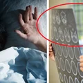 Koszmary mogą sygnalizować poważne choroby! Sprawdź koniecznie!