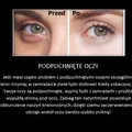 Sposób na podpuchnięte oczy