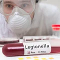 Tragiczne skutki zakażeń Legionellą! 4 ofiary śmiertelne! Powołano sztab kryzysowy!