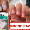 Zobacz sprawdzone sposoby na WZMOCNIENIE PAZNOKCI
