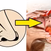 Wągry – pozbądź się ich za pomocą domowych peelingów!