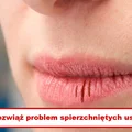 Masz SPIERZCHNIĘTE USTA? Teraz problem rozwiązany!