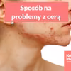 Przewlekły lęk i stres, a problemy z cerą