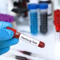 Są wyniki badań na obecność wirusa Marburg! Test przeszły dwie osoby poddane izolacji
