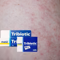 TRIBIOTIC - maść za około 2 złote, która potrafi zdziałać cuda!