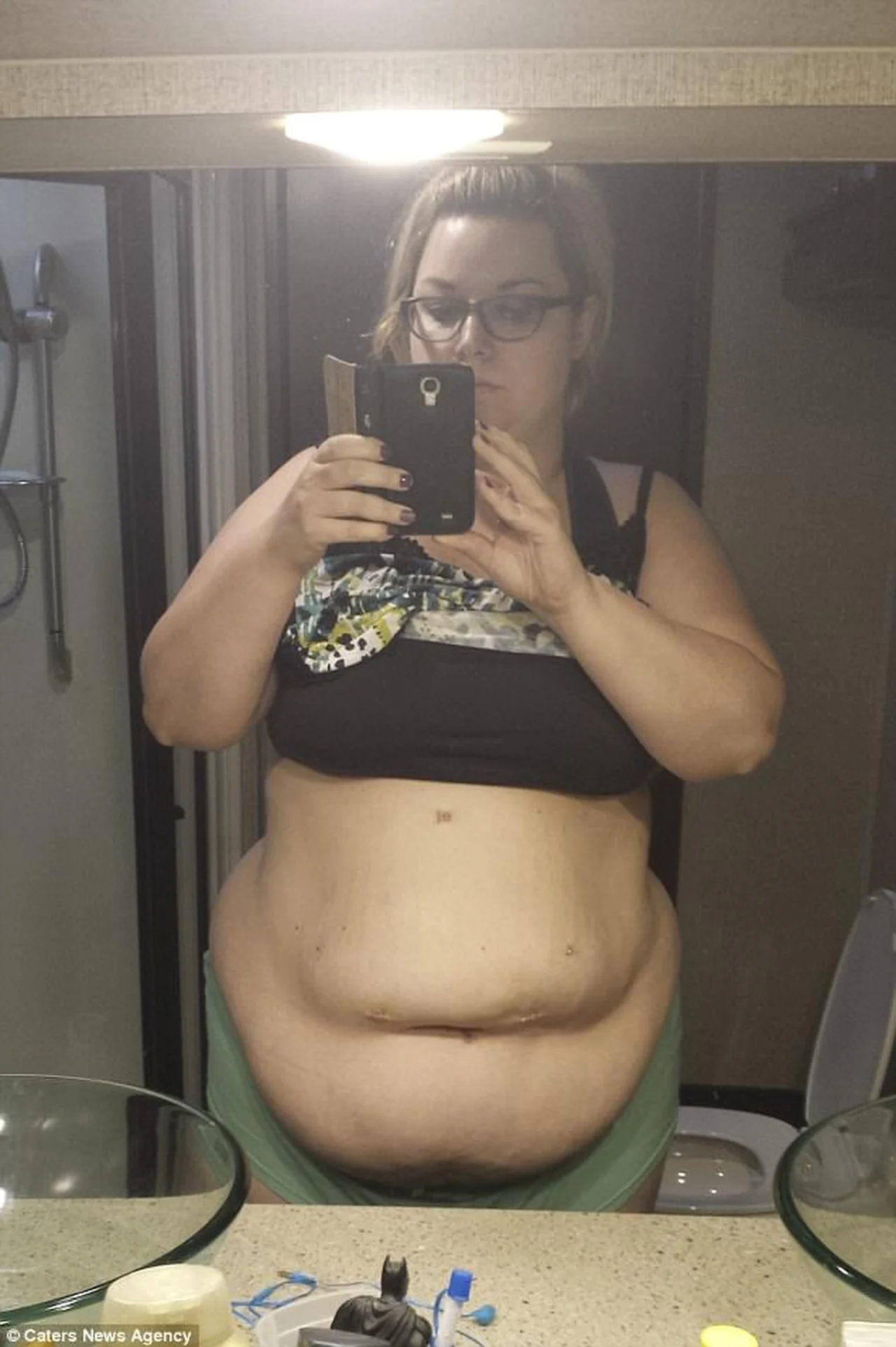 Zdecydowała się na operację i schudła 60 kg. Teraz twierdzi, że jej ciało wygląda jeszcze gorzej!