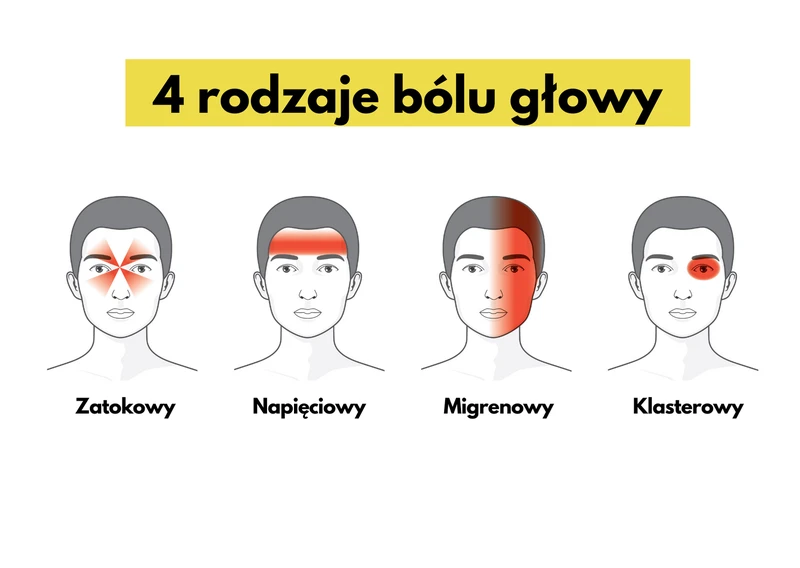 4 rodzaje bólu głowy. Jak je odróżnić?