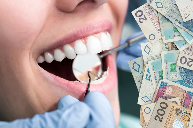 Nie płać za te zabiegi u dentysty! W 2025 roku możesz zaoszczędzić nawet 600 zł!