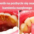 Prosty sposób na pozbycie się osadu i kamienia nazębnego.