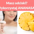 Masz odciski? Wykorzystaj ANANASA!