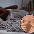 Nie możesz spać? Ten suplement na stres pomoże ci także w walce z trądzikiem!