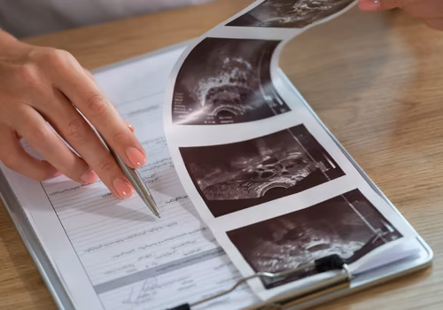 Utrata zasiłku chorobowego i nowe zasady kontroli L4! Idzie rewolucja w zwolnieniach lekarskich