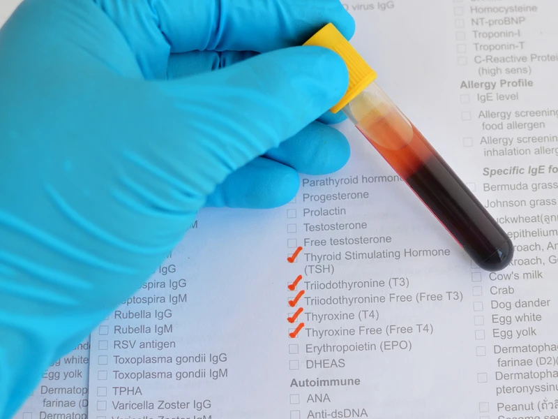 Masz takie objawy wiosną? Sprawdź poziom tych 5 hormonów!