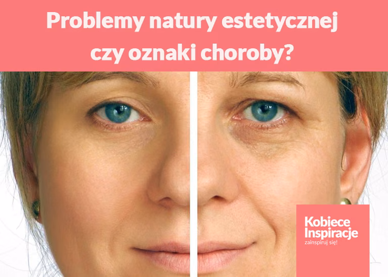 Problemy natury estetycznej, czy oznaki choroby?