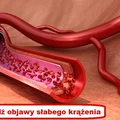 Te oznaki mogą świadczyć o ZŁYM KRĄŻENIU