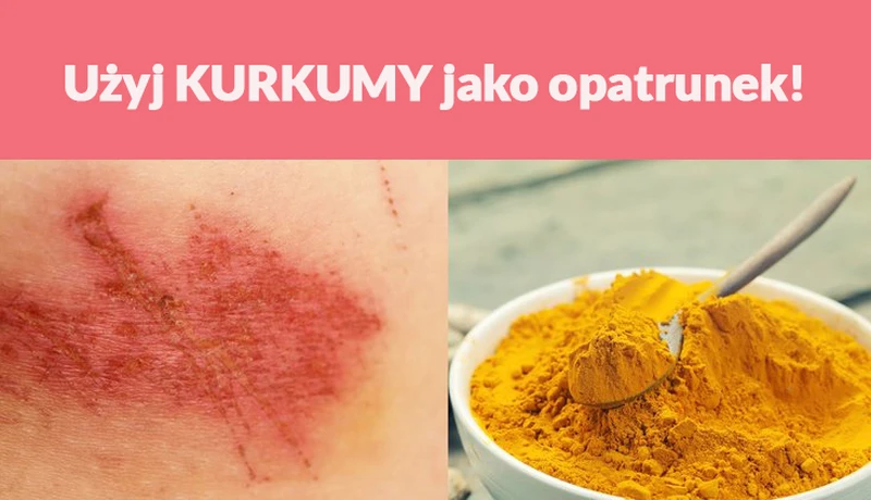 Użyj KURKUMY jako opatrunek!
