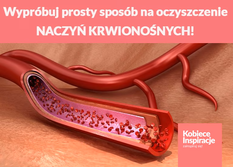 Wypróbuj prosty sposób na oczyszczenie NACZYŃ KRWIONOŚNYCH!