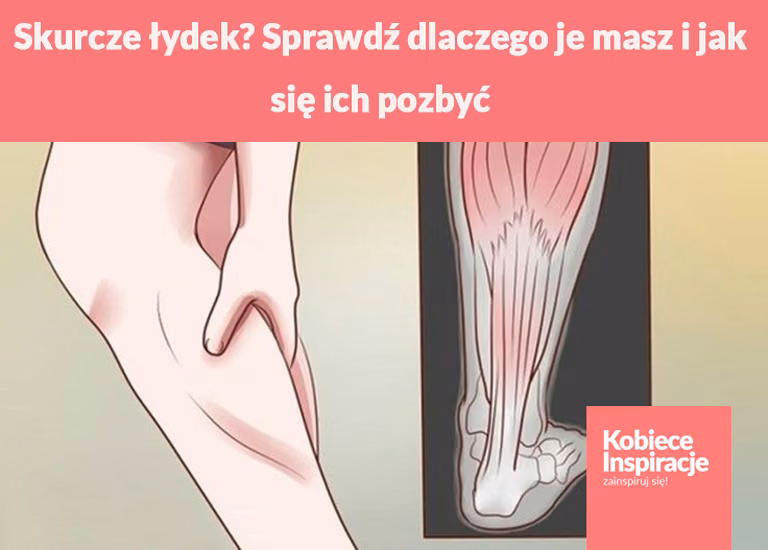 Skurcze łydek? Sprawdź dlaczego je masz i jak się ich pozbyć