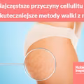 Najczęstsze przyczyny cellulitu i najskuteczniejsze metody walki z nim!