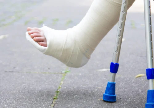 Tych kosztów nie obejmuje EKUZ! Wakacyjne problemy zdrowotne mogą kosztować fortunę
