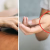 Masz takie znamię na ręce? Nie jesteś jedyna! Już wiadomo, co ono oznacza