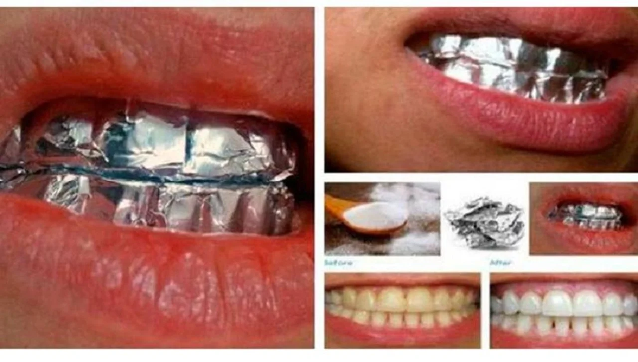 Domowe i skuteczne wybielanie zębów z folią aluminiową!