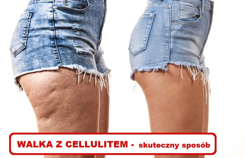 Walczysz z CELLULITEM? Ta mikstura Ci w tym pomoże!