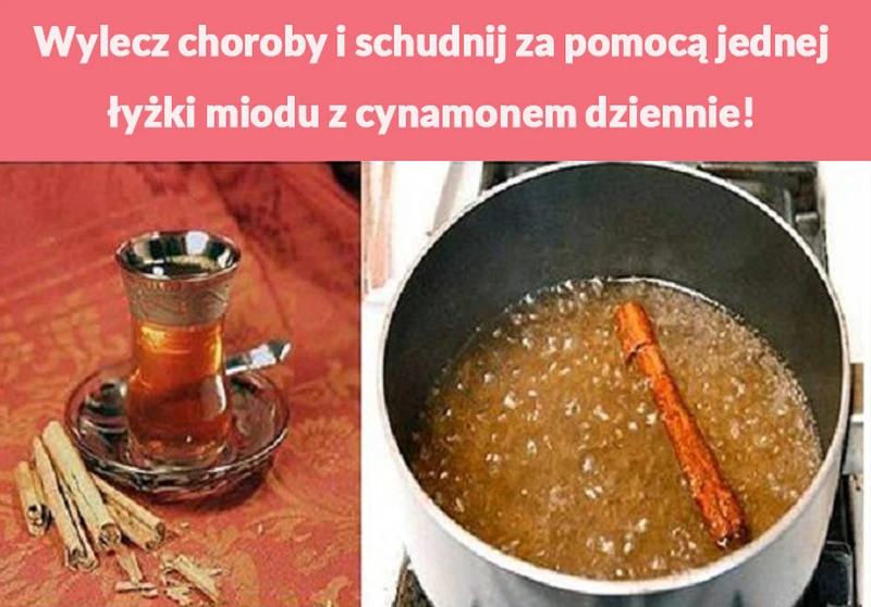 Wylecz choroby i schudnij za pomocą jednej łyżki miodu z cynamonem dziennie!