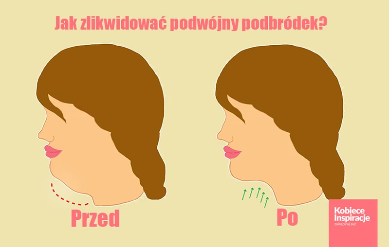 Jak zlikwidować podwójny podbródek?