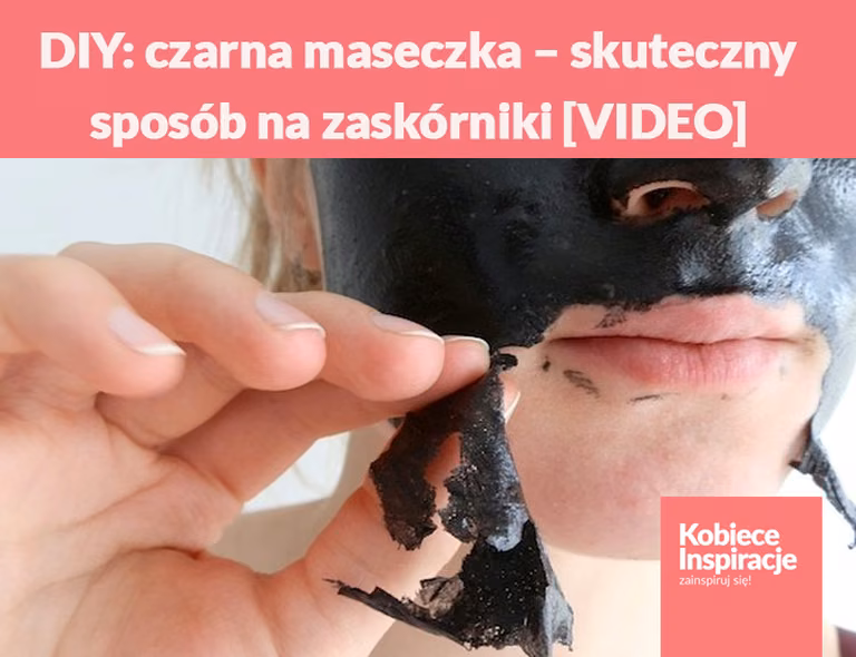 DIY: czarna maseczka – skuteczny sposób na zaskórniki [VIDEO]