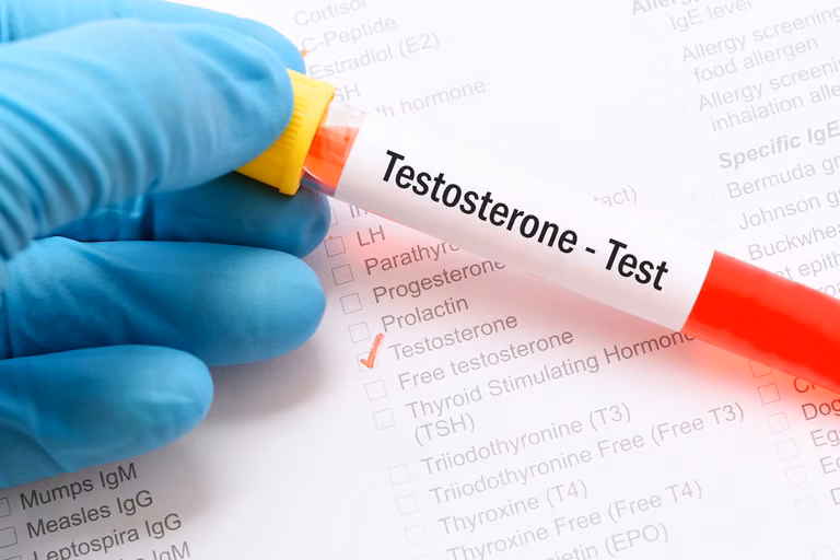Jakie są objawy niedoboru TESTOSTERONU?
