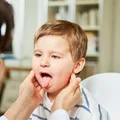 Angina: Bakteryjna czy Wirusowa? Jak je odróżnić? Kiedy antybiotyk? Sprawdź!